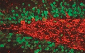 一级抗体 一抗载玻片