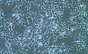 HEK-293T 细胞的显微图像。四角有大尖峰的矩形代表细胞覆盖了整个图像。
