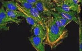 小点覆盖细胞表面，因此没有一个点是完全可见的。细胞内可见 F-肌动蛋白，呈长直线，覆盖整个细胞。细胞核在每个细胞中间呈椭圆形。这些细胞覆盖了图像的顶部，并延伸到图像的底部中间。