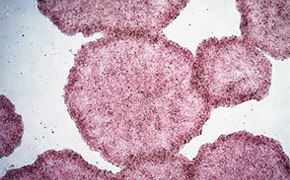 用碱性磷酸酶(AP)染色的 H9 人类 ES 细胞 用碱性磷酸酶(AP)染色的 H9 人类 ES 细胞