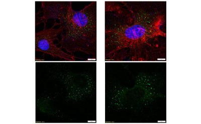 There are four immunocytochemistry images. The top left image has two cells outlined with two ovals in the middle that represent the nucleus. There are small dots throughout the cells. In the top right image, there is a rectangle that represents the cell with an oval that represents the nucleus. There are small dots throughout the cell. In the bottom images there are small dots that correspond to the dots in the top images