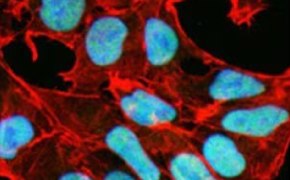 The cells are rectangles that cover the image, with ovals in the middle of the rectangles that represent the nucleus.