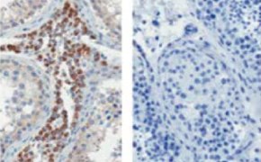 Immunohistochemistry of embedded human testis tissue sections. Each image has ovals that represent cells in different colors. 
