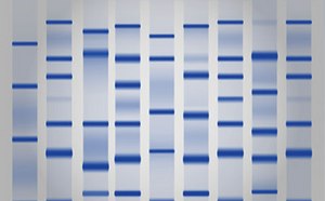 Protein Electrophoresis & Western Blotting