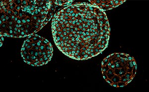 Microscopy image of pancreatic ductal adenocarcinoma organoids