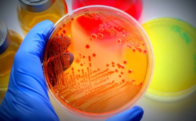 Petri dish with visible bacterial growth