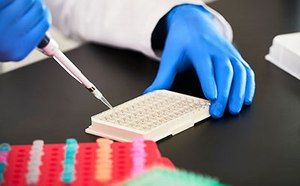 MILLIPLEX®定制多重检测试剂盒和ELISA