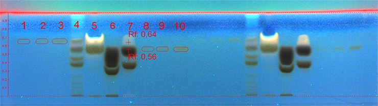 Developed and derivatized plate at 366 nm. Chromatographic data shown further down in tabulated form.