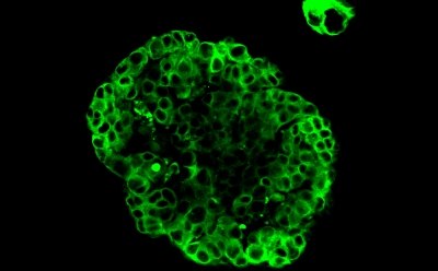 3D organoid culture