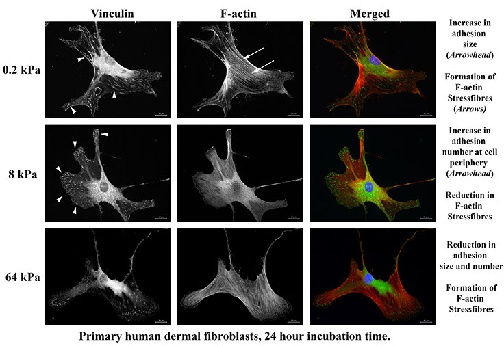 A elastic modulus of 8 kPA is an optimal matrix stiffness for dermal fibroblasts showing a reduction in F-actin stress fibers and increased cell adhesion (Vinculin) when compared with 0.2 or 64 kPa matrix stiffnesses. Primary human dermal fibroblast matrix stiffness optimization.