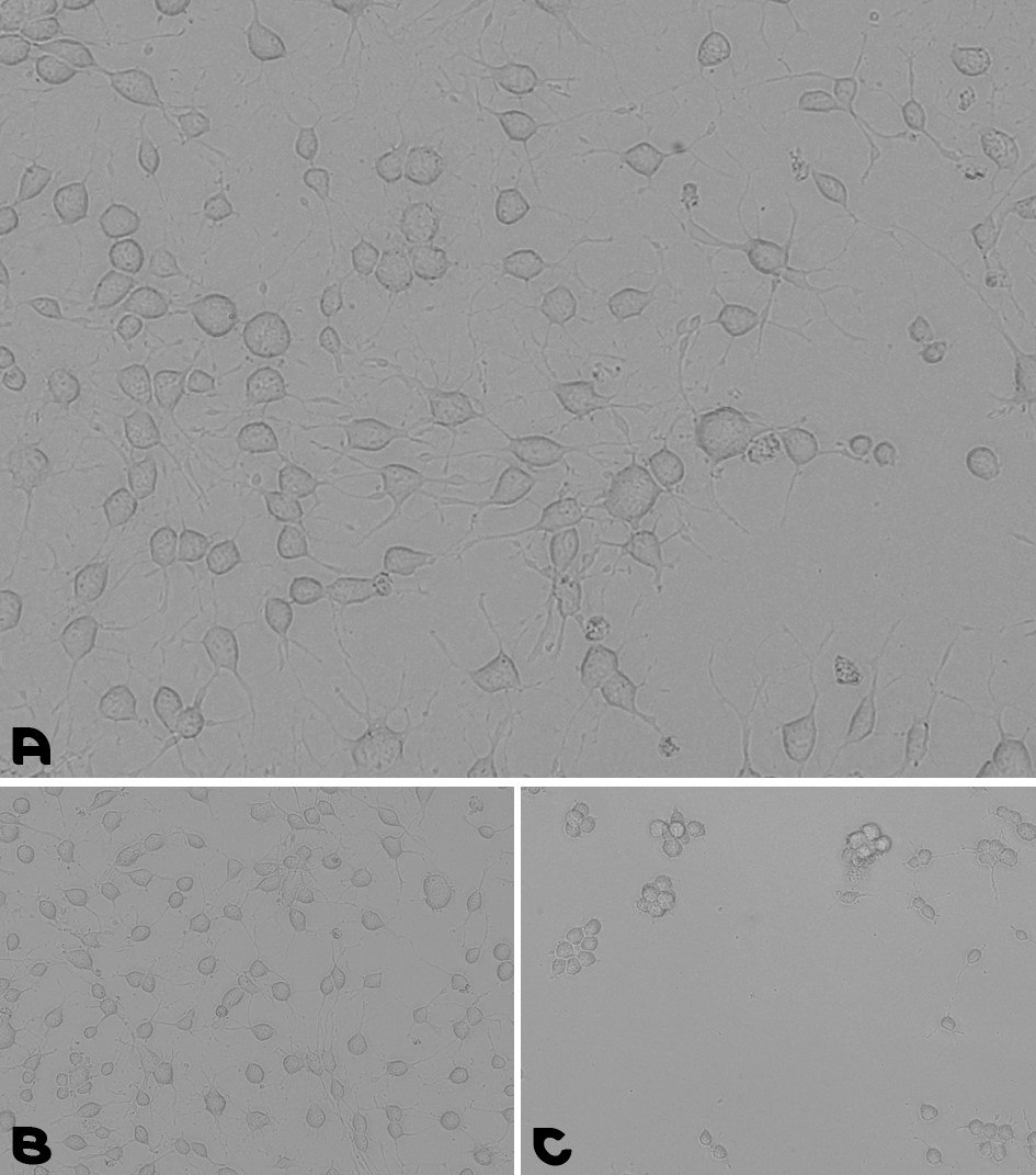 Microscopy images of cell adhesion during a neural stem cells culturing assay