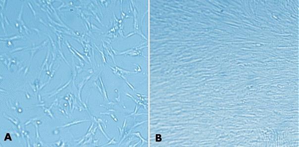 MaxGel™ ECM enables improved expansion of MRC-5 cells.