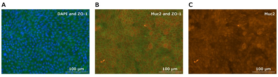 Immunofluorescent staining Duo-87 organoids directly on Millicell® 24-well inserts taken directly from the insert placed in PBS-rinsed glass bottom dishes. In the first image misshapen ovals cover the entire field, stained with more color than the background. There are smaller ovals that inside each over that represent the cellular nucleus. In the middle image the same mishappen ovals cover the image. The lines that outline each cell are a different color than the color that fills the cell. In the last image the ovals are no longer outlines but filled with the same color as the middle image. These ovals cover the whole image.