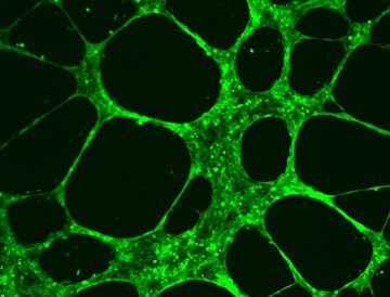 HUVEC Angiogenesis Assay