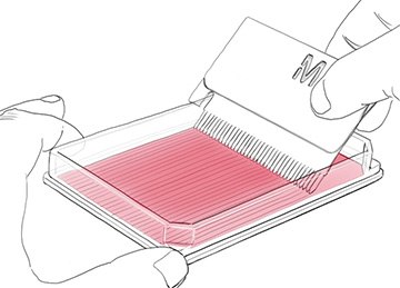 In Vitro Scratch Assay