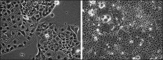 Caco-2 cells in culture. Caco-2 cells at low density (first panel) and high density (second panel).