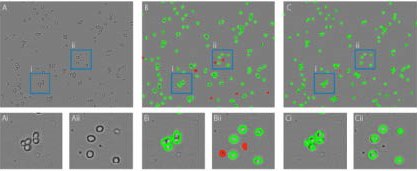 Improvement of the artificial intelligence algorithm of the Corning Cell Counter. A) unprocessed image. B) Results of the old algorithm, many cells in clusters are not detected properly and debris is wrongly detected as dead cells. C) Results of the new algorithm, all individual cells within clusters are detected properly and no debris is detected as dead cells. Ai-Cii) Zoomed in images of blue boxes containing examples of the improved individual cell detection (i) and dead cell detection (ii).