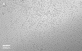 Brightfield imaging of L929 cells on Millicell<sup>®</sup> DCI Digital Cell Imager at 10X magnification