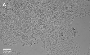 Brightfield imaging of C1008 cells on Millicell<sup>®</sup> DCI Digital Cell Imager at 10X magnification