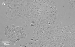 Brightfield imaging of T24T cells on Millicell<sup>®</sup> DCI Digital Cell Imager at 20X magnification