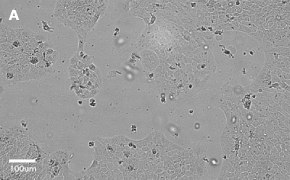 Brightfield imaging of A431 cells on Millicell<sup>®</sup> DCI Digital Cell Imager at 10X magnification