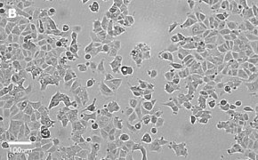 Brightfield imaging of MCF-7 cells on Millicell<sup>®</sup> DCI Digital Cell Imager at 20X magnification