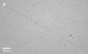 Brightfield imaging of WI38 cells on Millicell<sup>®</sup> DCI Digital Cell Imager at 10X magnification