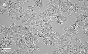 Brightfield imaging of HCT116 cells on Millicell<sup>®</sup> DCI Digital Cell Imager at 10X magnification