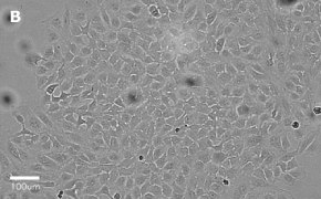 Brightfield imaging of HeLa cells on Millicell<sup>®</sup> DCI Digital Cell Imager at 20X magnification