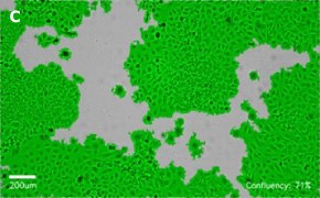 Brightfield imaging of HeLa cells on Millicell<sup>®</sup> DCI Digital Cell Imager at 10X magnification with mask