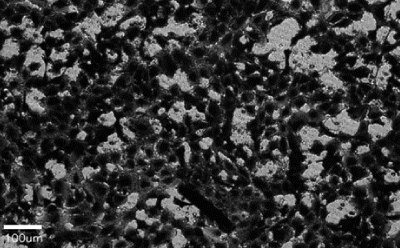 Cell migration