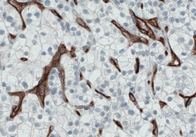 Immunohistochemical staining of Endoglin/CD105