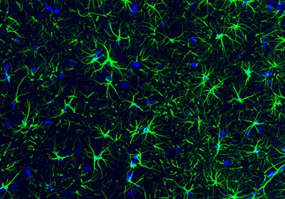 Immunofluorescence staining of rat hippocampus shows strong positivity of the astrocytes.