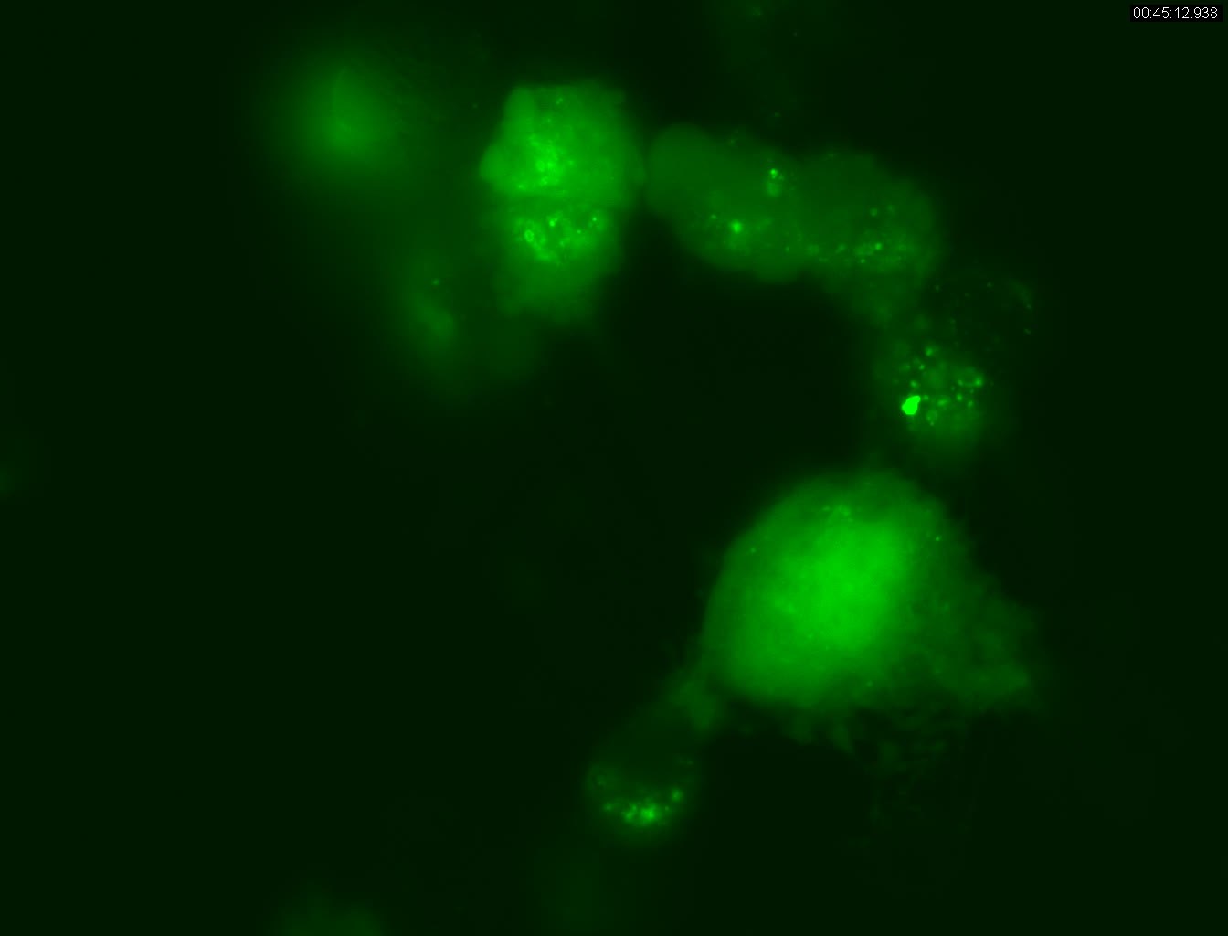 Live Cell Imaging of Autophagy using LentiBrite™ Fluorescent Biosensors