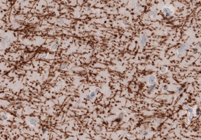 Immunohistochemical staining of the human cerebral cortex  .