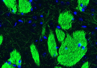 Immunofluorescence staining of mouse striatum.