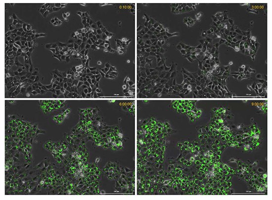 Time course of hypoxia in live cancer cells.