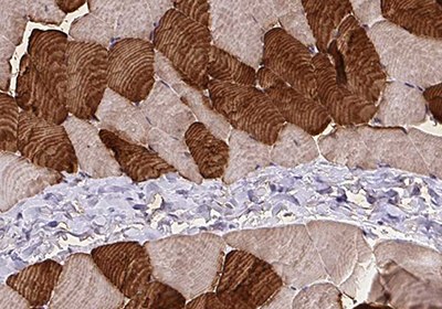 Immunohistochemical staining of skeletal muscle cell (SMC)