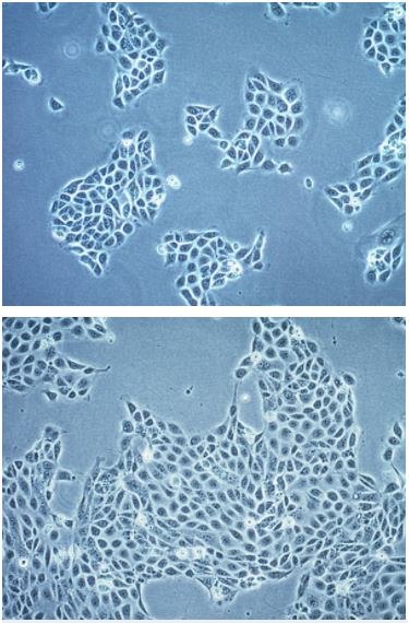 16HBE14o- cell line-High density human bronchial epithelial cells