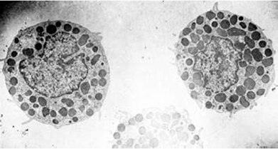 Electron micrograph of mast cells isolated by gradient centrifugation on Percoll