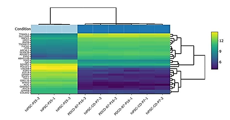 Heatmap of top 30 differentially expressed genes