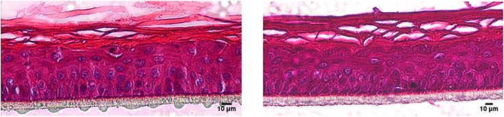 Hematoxylin/eosin staining of RhE models cultivated in the cell culture Insert 2in1 (right) and in an insert from another manufacturer (left).