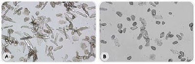 Photomicrographs of isolated cardiomyocytes prepared with freshly purified and ultrafiltered water (A) or stored, ultrapure water without ultrafiltration (B). Many more viable cardiomyocytes were obtained in water A, as shown by their elongated and striated shape. 