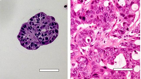 Histological and morphological comparison of acinar/papillary 3dGro™ human lung organoids