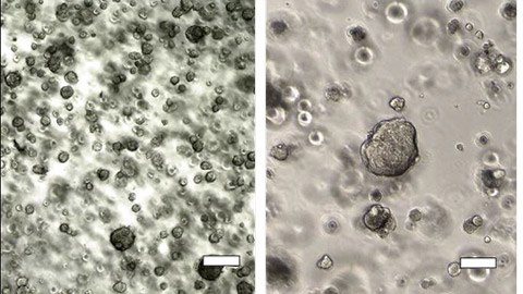 Histological and morphological comparison of acinar/papillary 3dGro™ human lung organoids