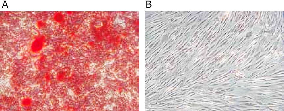 microscopic-appearance-of-hob