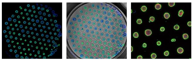 Microscopy images of PDAC organoids cultured in Millicell® Microwell plates and stained with EpCAM in green, which surrounds each organoid, action in red, which is in the center of each organoid, and DAPI in blue, which is in the center of each organoid. In the first image, multiple small blue and green circles are in a hexagon grid in the center of a black background. In the second image, multiple small blue and green circles are in a hexagon grid and within slightly larger grey circles, indicating the microwell grid. In the third image, slightly larger green and red circles are spaced evenly on a black background.