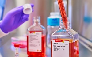 用于细胞和组织培养的血清