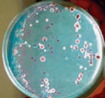 Candida Ident Agar, modified