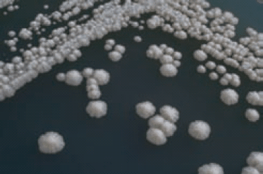 Several baker’s yeast colonies on a microbiological medium